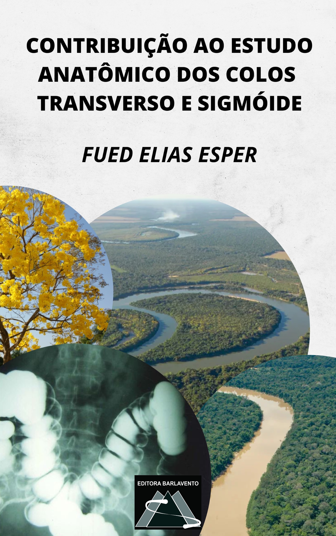 Contribuição ao estudo anatômica dos colos transverso e sigmoide